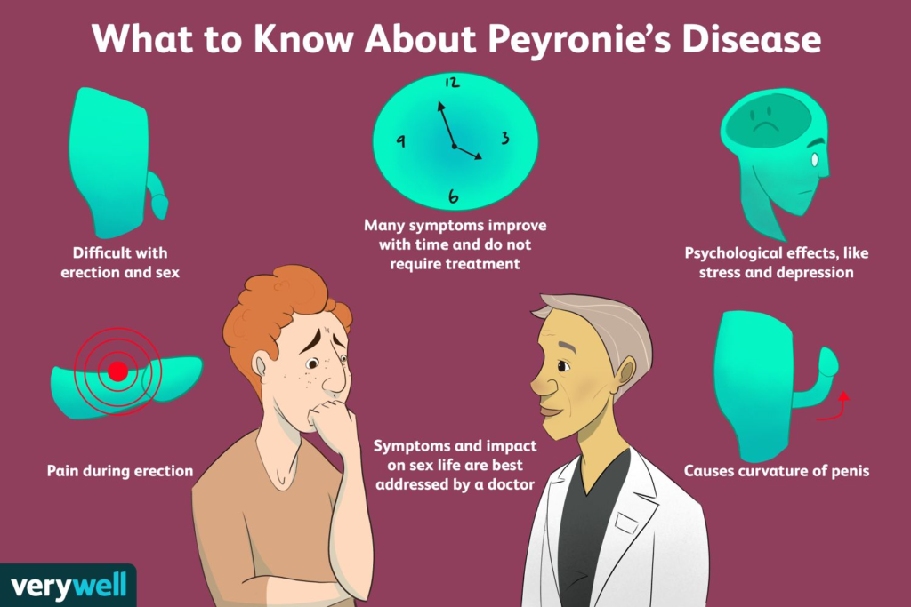 peyronie's disease pictures